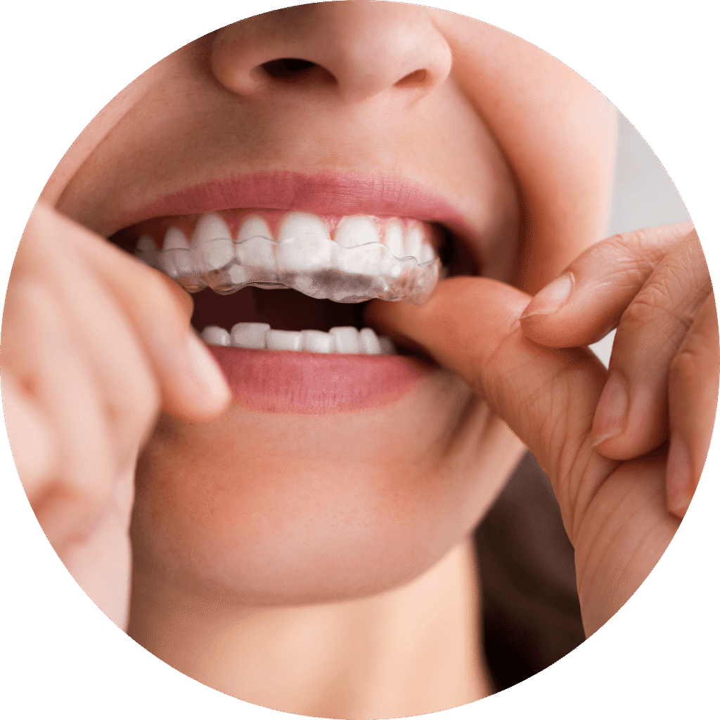 Tratamiento del Bruxismo